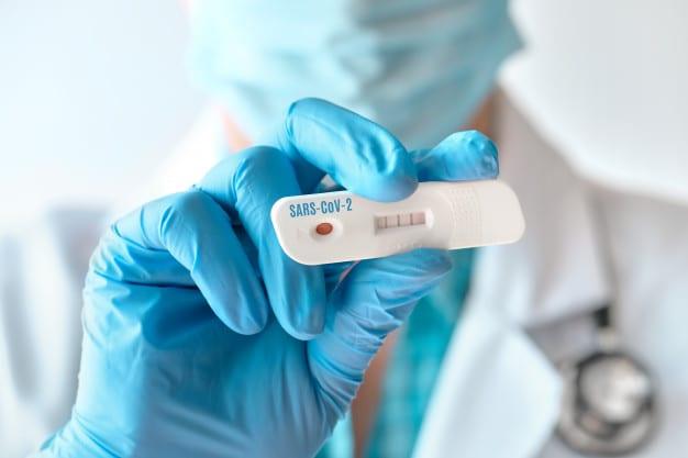 doctor-shows-rapid-laboratory-covid-19-test-detection-igm-igg-antibodies-novel-coronavirus-sars-cov-2-with-positive-result_87646-6971